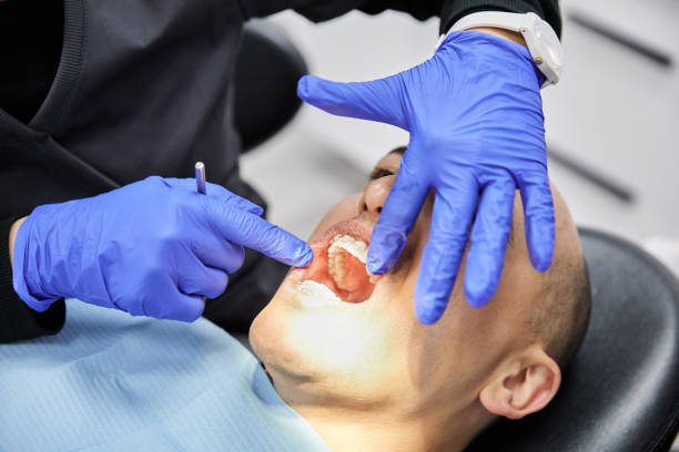 Best Emergency Dentist for Lost Fillings or Crowns in San Elizario, TX